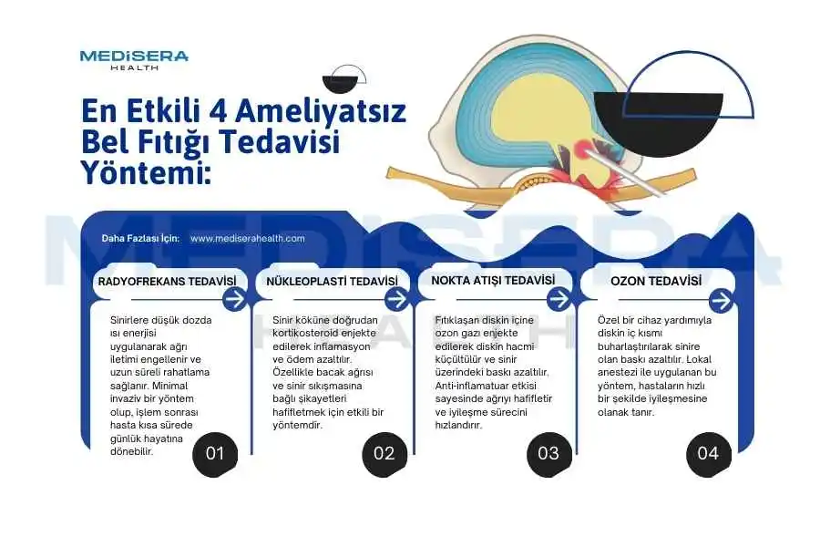 ameliyatsız bel fıtığı tedavisi