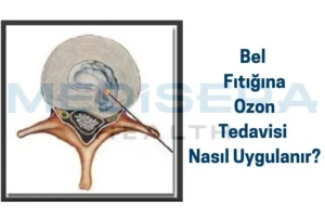 bel fıtığı ozon tedavisi