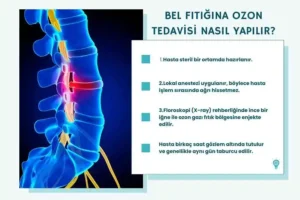 bel fıtığına ozon tedavisi nasıl yapılır