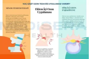 kaç çeşit ozon tedavisi var