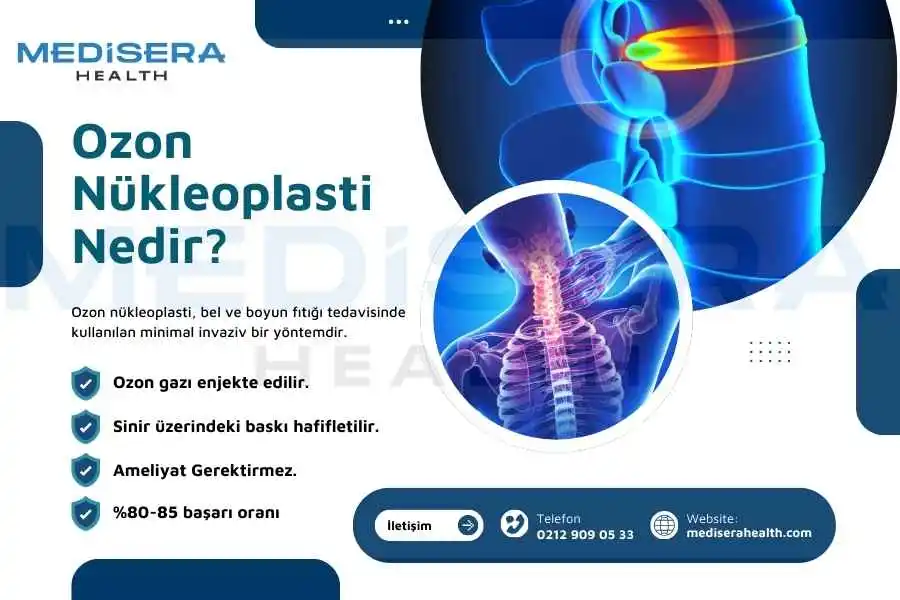 ozon nükleoplasti nedir