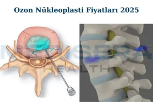 ozon tedavisi fiyatları 2025